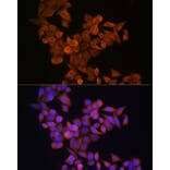 Immunofluorescence - Anti-S100A14 Antibody (A12919) - Antibodies.com