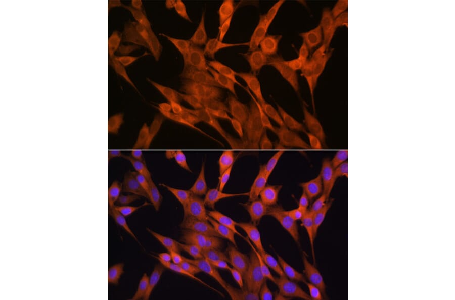 Immunofluorescence - Anti-S100A14 Antibody (A12919) - Antibodies.com