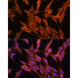 Immunofluorescence - Anti-S100A14 Antibody (A12919) - Antibodies.com