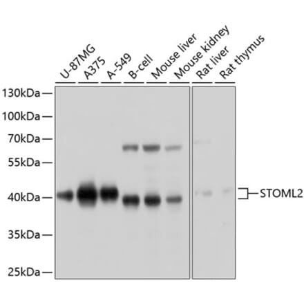 Western Blot - Anti-SLP-2 Antibody (A12920) - Antibodies.com