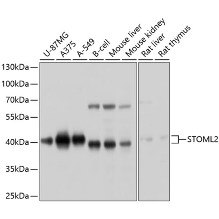 Western Blot - Anti-SLP-2 Antibody (A12920) - Antibodies.com