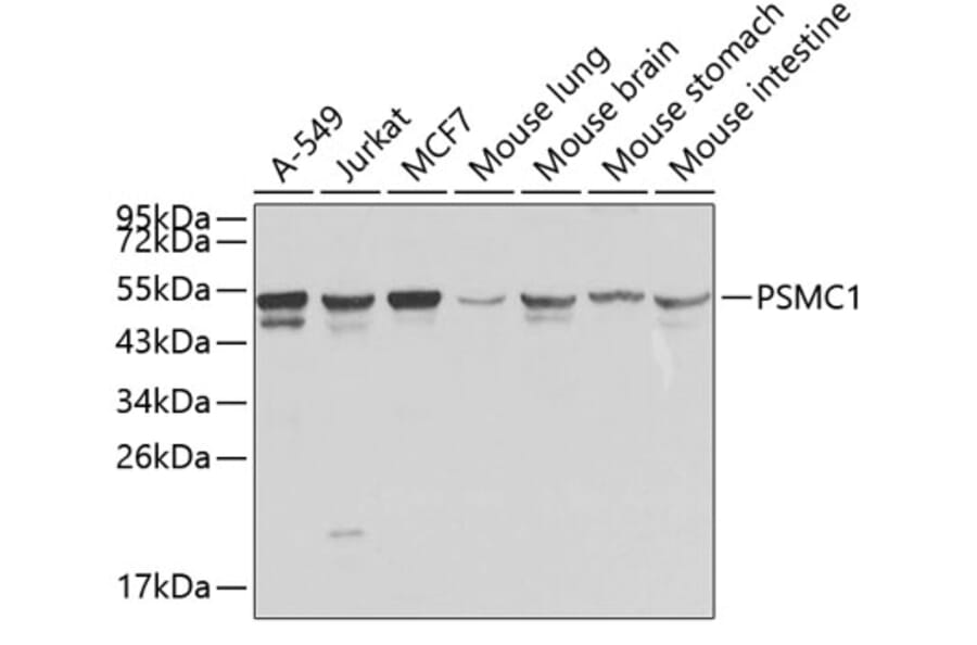 Western Blot - Anti-PSMC1 Antibody (A1040) - Antibodies.com