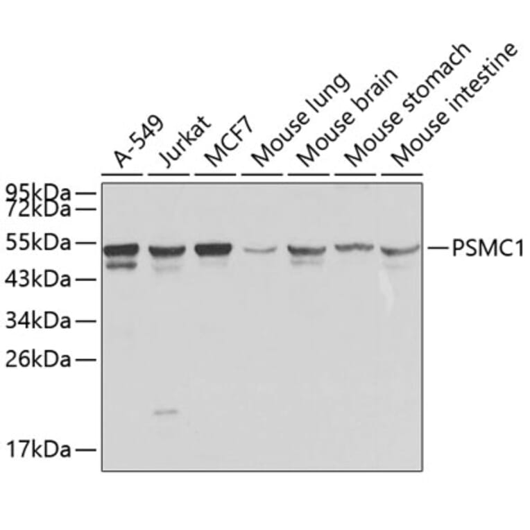Western Blot - Anti-PSMC1 Antibody (A1040) - Antibodies.com
