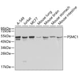 Western Blot - Anti-PSMC1 Antibody (A1040) - Antibodies.com