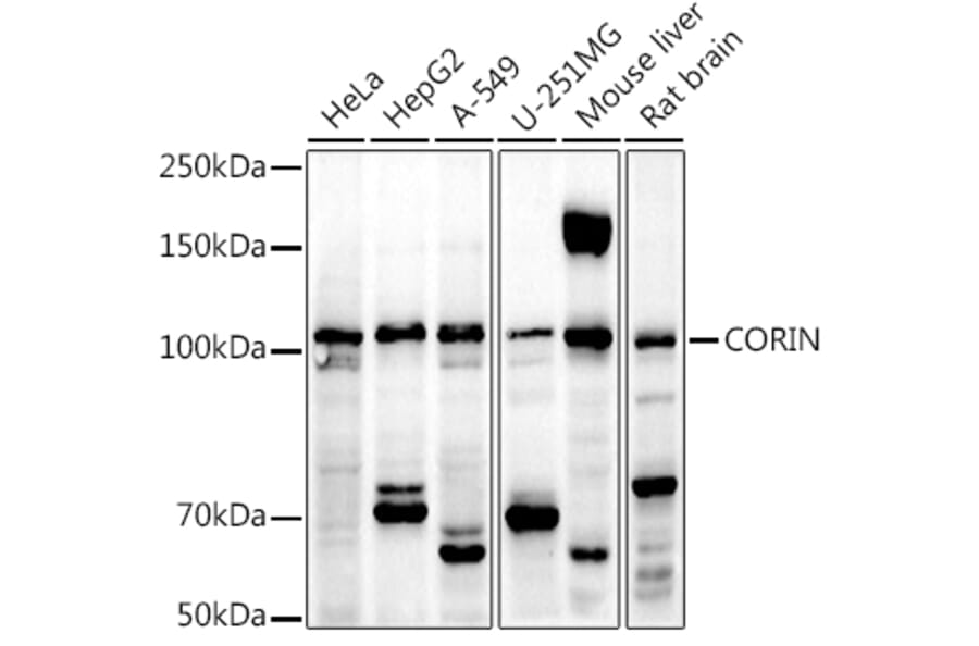 Western Blot - Anti-Corin Antibody (A12922) - Antibodies.com