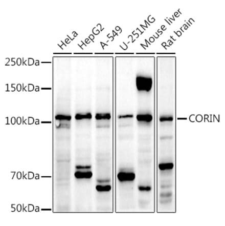 Western Blot - Anti-Corin Antibody (A12922) - Antibodies.com