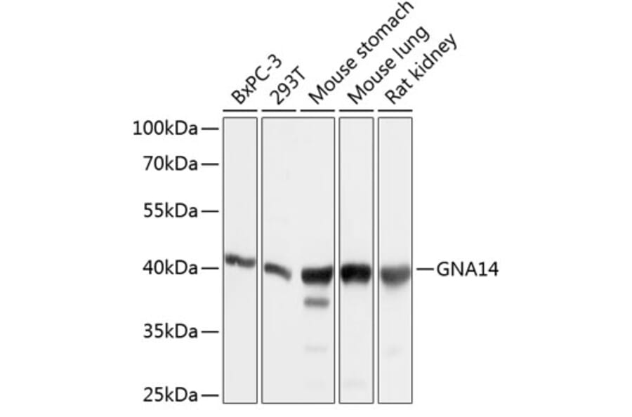 Western Blot - Anti-GNA14 Antibody (A12923) - Antibodies.com