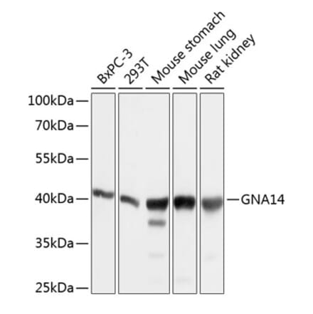 Western Blot - Anti-GNA14 Antibody (A12923) - Antibodies.com