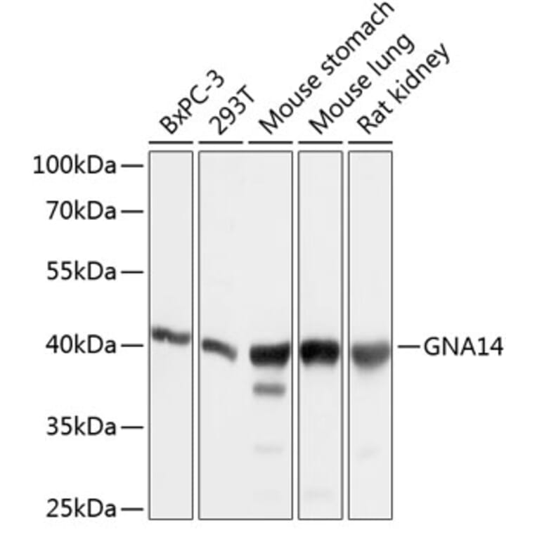 Western Blot - Anti-GNA14 Antibody (A12923) - Antibodies.com