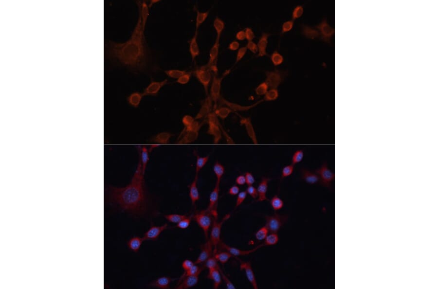 Immunofluorescence - Anti-GNA14 Antibody (A12923) - Antibodies.com