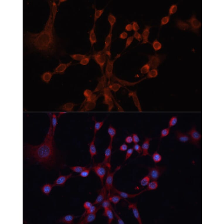 Immunofluorescence - Anti-GNA14 Antibody (A12923) - Antibodies.com