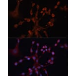 Immunofluorescence - Anti-GNA14 Antibody (A12923) - Antibodies.com