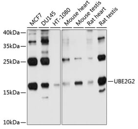 Western Blot - Anti-Ube2G2 Antibody (A12924) - Antibodies.com