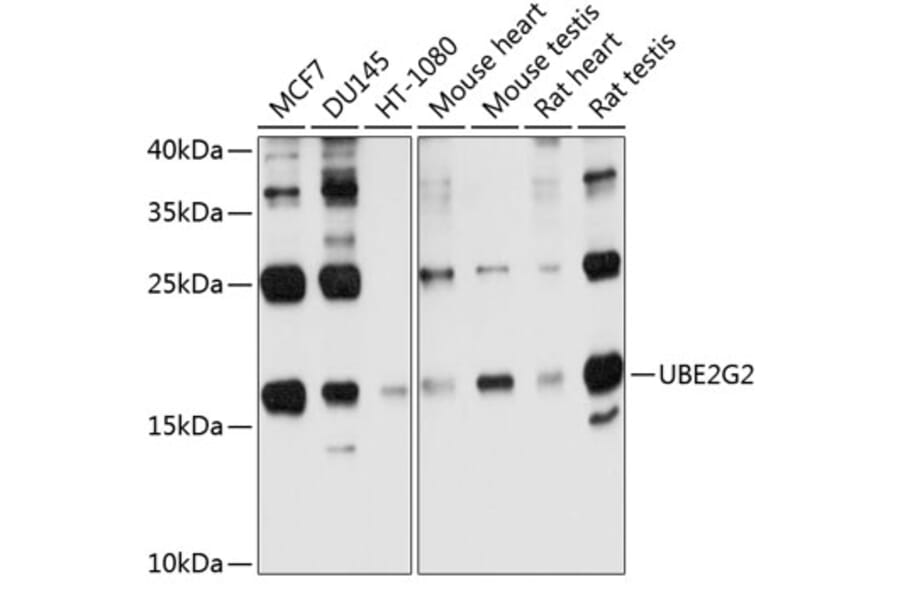 Western Blot - Anti-Ube2G2 Antibody (A12924) - Antibodies.com