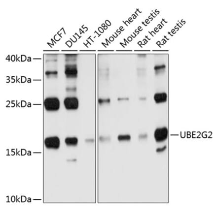 Western Blot - Anti-Ube2G2 Antibody (A12924) - Antibodies.com