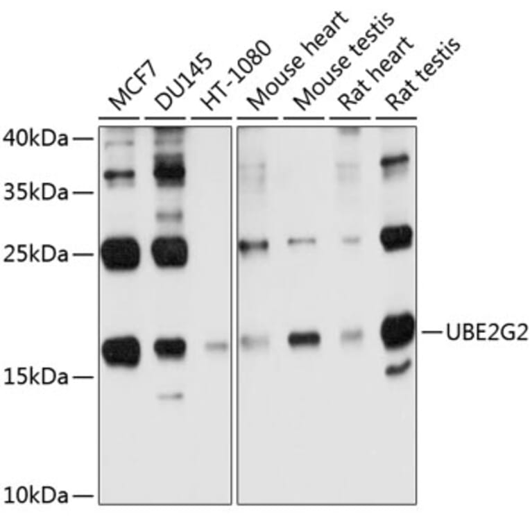 Western Blot - Anti-Ube2G2 Antibody (A12924) - Antibodies.com