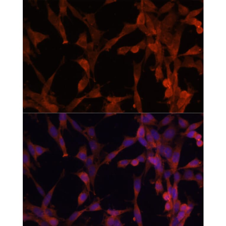 Immunofluorescence - Anti-Ube2G2 Antibody (A12924) - Antibodies.com