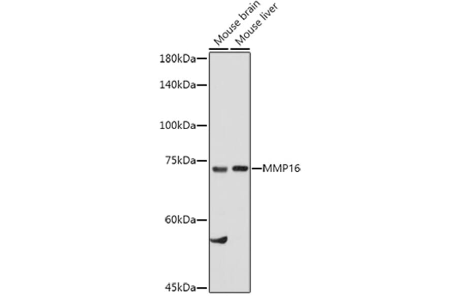 Western Blot - Anti-MMP16 Antibody (A12925) - Antibodies.com