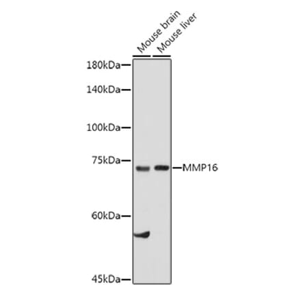 Western Blot - Anti-MMP16 Antibody (A12925) - Antibodies.com