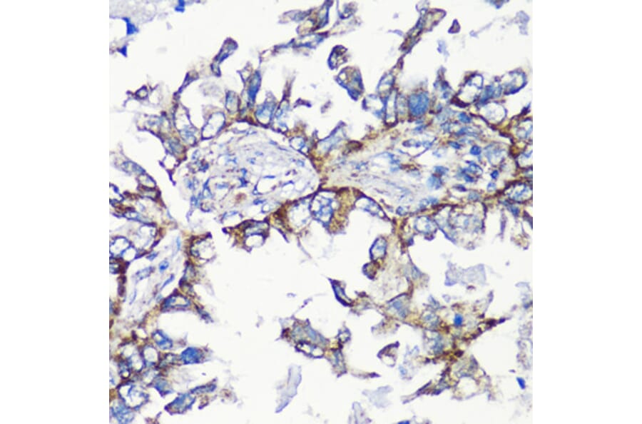 Immunohistochemistry - Anti-MMP16 Antibody (A12925) - Antibodies.com