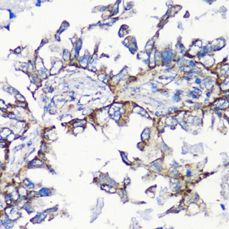 Immunohistochemistry - Anti-MMP16 Antibody (A12925) - Antibodies.com