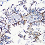 Immunohistochemistry - Anti-MMP16 Antibody (A12925) - Antibodies.com