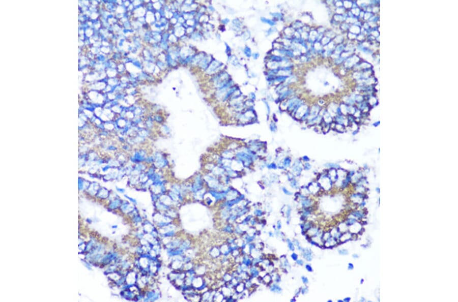 Immunohistochemistry - Anti-MMP16 Antibody (A12925) - Antibodies.com