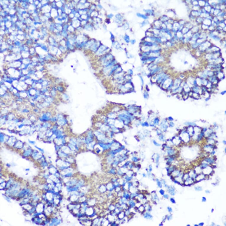 Immunohistochemistry - Anti-MMP16 Antibody (A12925) - Antibodies.com