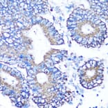 Immunohistochemistry - Anti-MMP16 Antibody (A12925) - Antibodies.com
