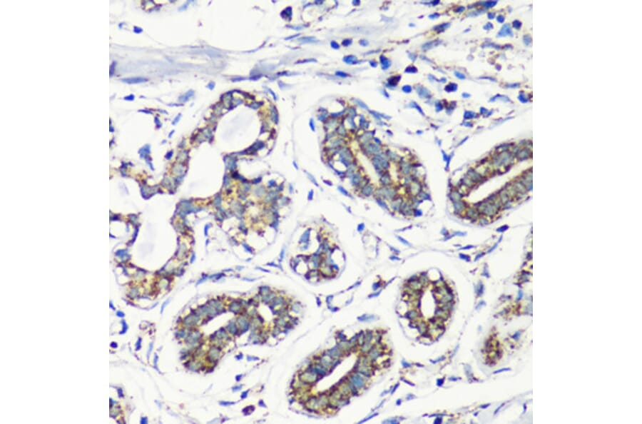 Immunohistochemistry - Anti-MMP16 Antibody (A12925) - Antibodies.com