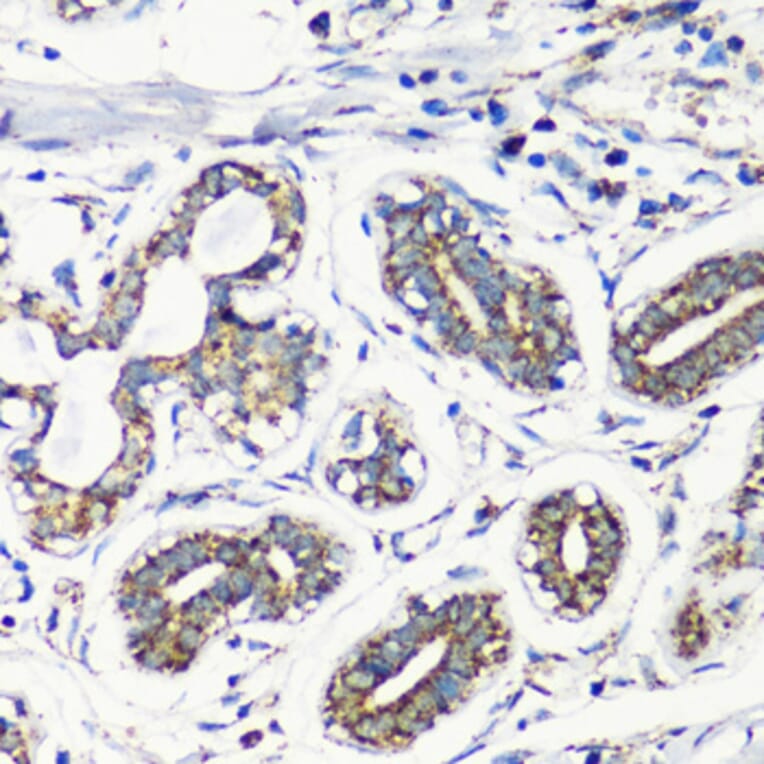 Immunohistochemistry - Anti-MMP16 Antibody (A12925) - Antibodies.com
