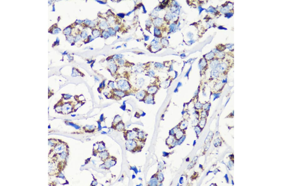 Immunohistochemistry - Anti-MMP16 Antibody (A12925) - Antibodies.com