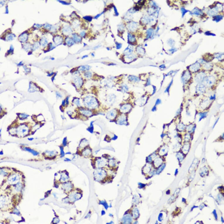 Immunohistochemistry - Anti-MMP16 Antibody (A12925) - Antibodies.com