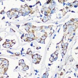 Immunohistochemistry - Anti-MMP16 Antibody (A12925) - Antibodies.com