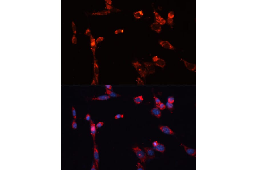 Immunofluorescence - Anti-MMP16 Antibody (A12925) - Antibodies.com