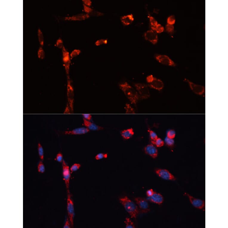 Immunofluorescence - Anti-MMP16 Antibody (A12925) - Antibodies.com