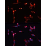 Immunofluorescence - Anti-MMP16 Antibody (A12925) - Antibodies.com