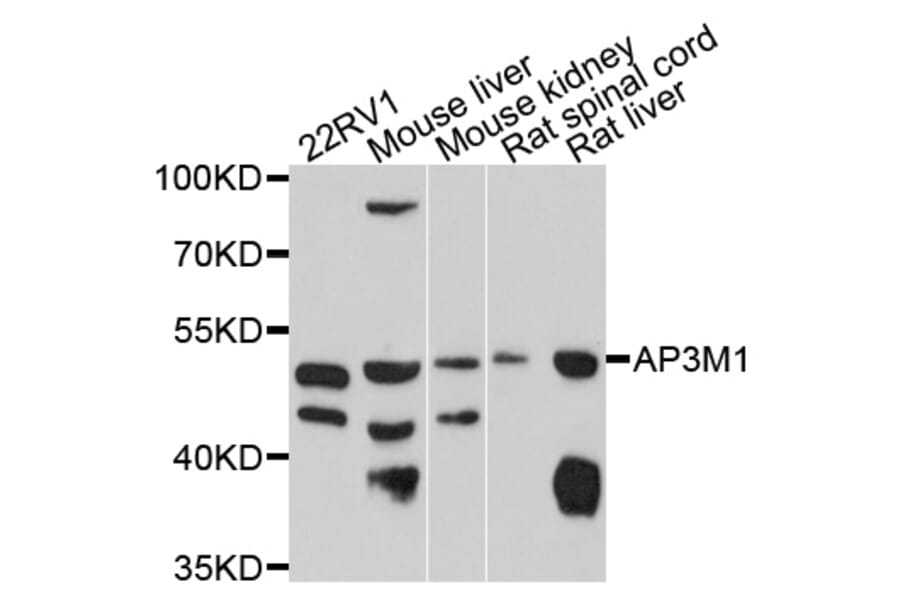 Western Blot - Anti-AP3M1 Antibody (A10410) - Antibodies.com