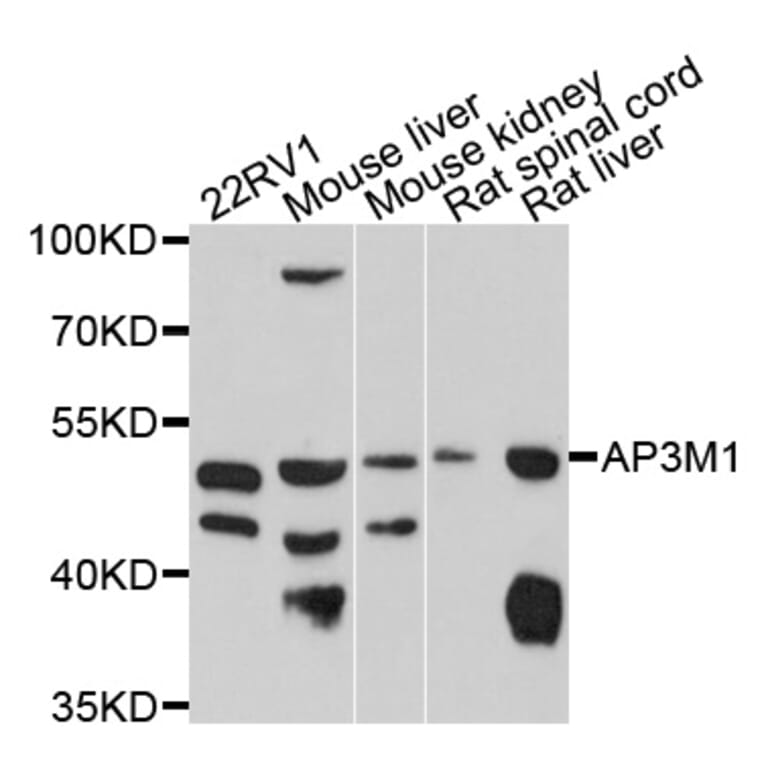 Western Blot - Anti-AP3M1 Antibody (A10410) - Antibodies.com