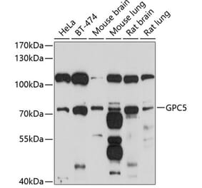 Western Blot - Anti-Glypican 5 Antibody (A12927) - Antibodies.com