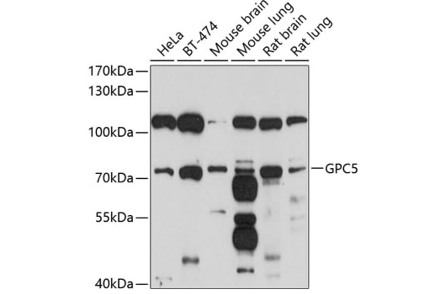 Western Blot - Anti-Glypican 5 Antibody (A12927) - Antibodies.com