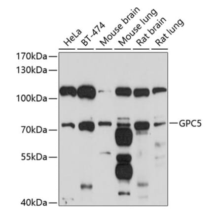 Western Blot - Anti-Glypican 5 Antibody (A12927) - Antibodies.com