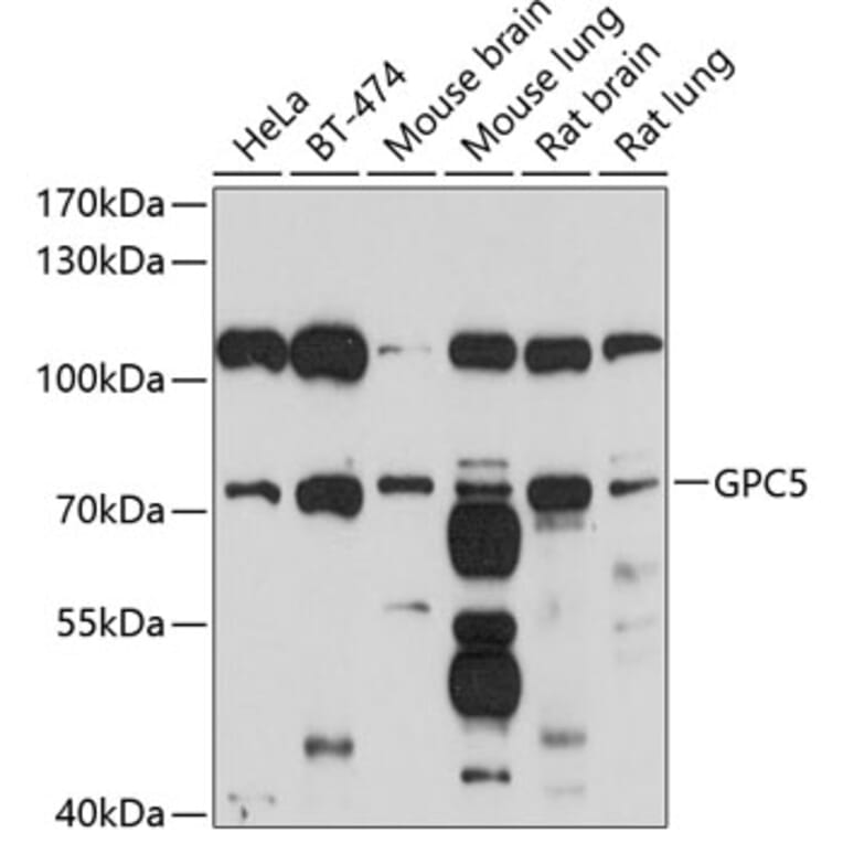 Western Blot - Anti-Glypican 5 Antibody (A12927) - Antibodies.com