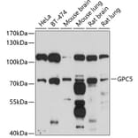 Western Blot - Anti-Glypican 5 Antibody (A12927) - Antibodies.com