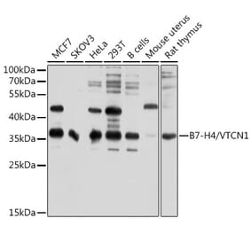 Western Blot - Anti-B7H4 Antibody (A12928) - Antibodies.com