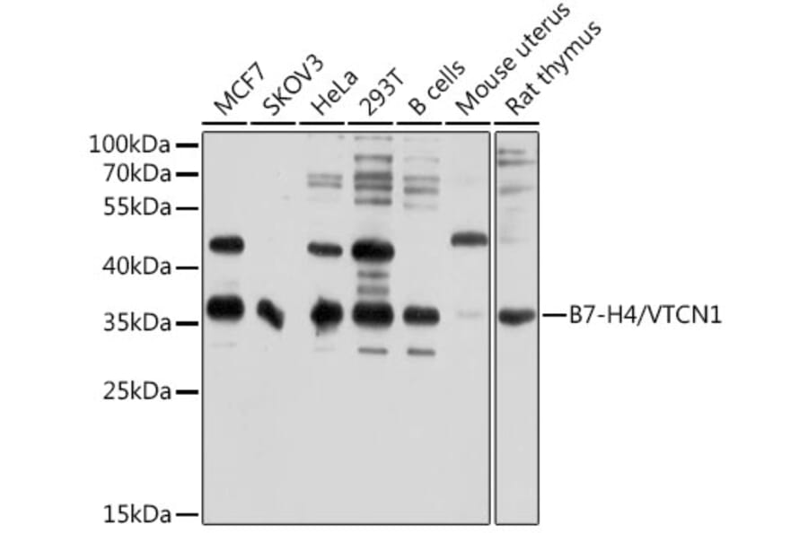Western Blot - Anti-B7H4 Antibody (A12928) - Antibodies.com