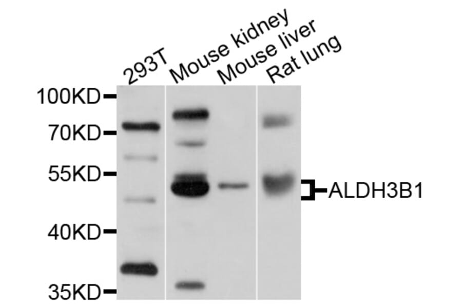Western Blot - Anti-ALDH3B1 Antibody (A10415) - Antibodies.com