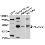 Western Blot - Anti-ALDH3B1 Antibody (A10415) - Antibodies.com