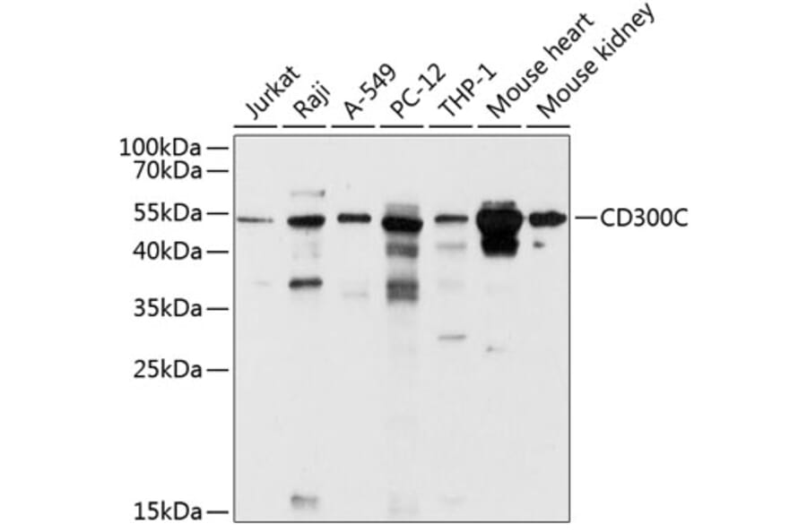 Western Blot - Anti-CD300C Antibody (A12930) - Antibodies.com