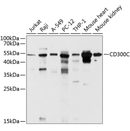 Western Blot - Anti-CD300C Antibody (A12930) - Antibodies.com